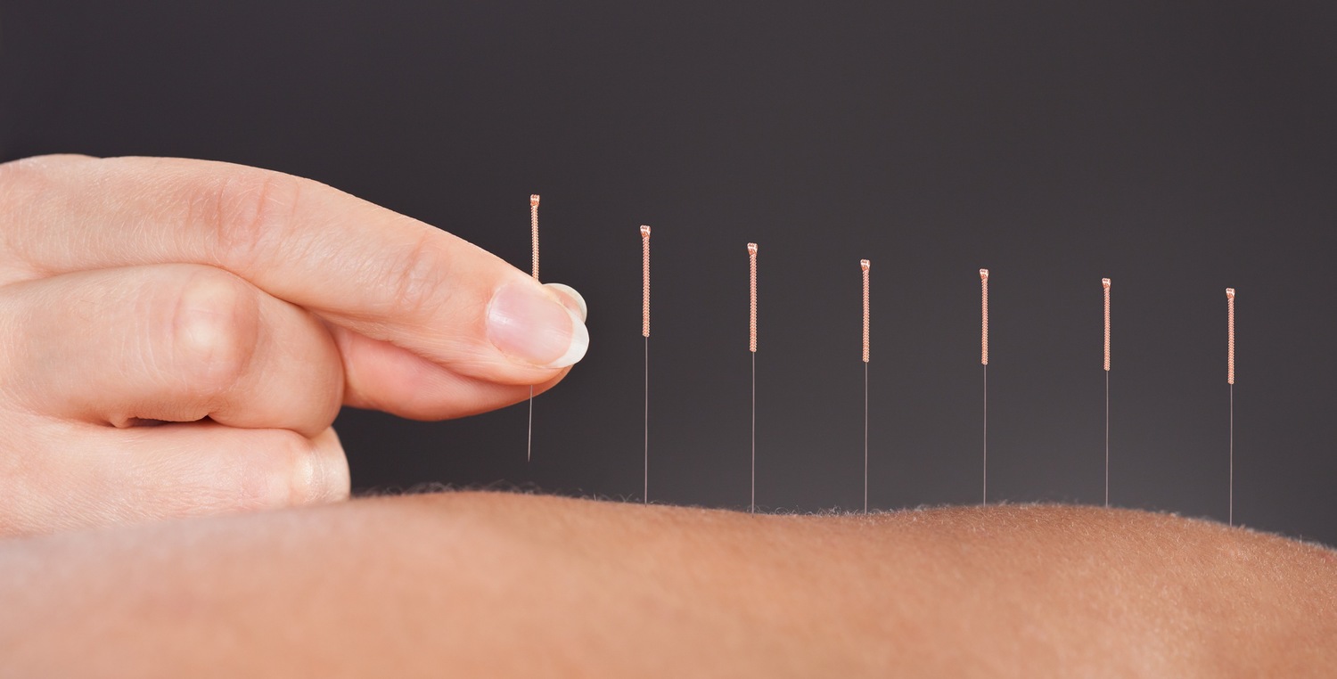 Acupuncture Central Florida Lifestyle