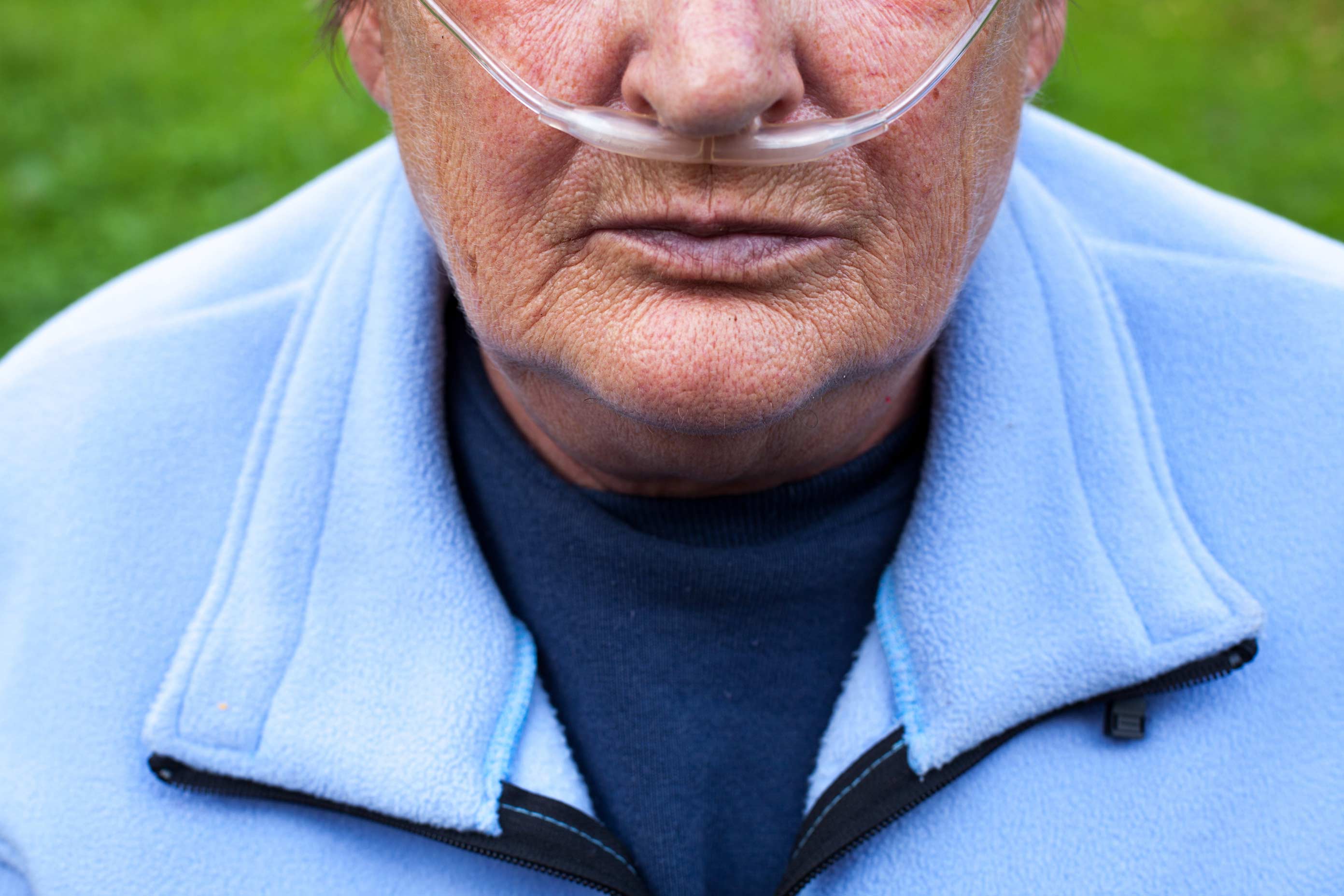 Living with Pulmonary Fibrosis